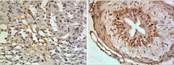 CXCL16 Antibody (RM0208-15Q2) - Azide and BSA Free, Novus Biologicals 0.1 mg | Buy Online | Novus Biologicals | Fisher Scientific